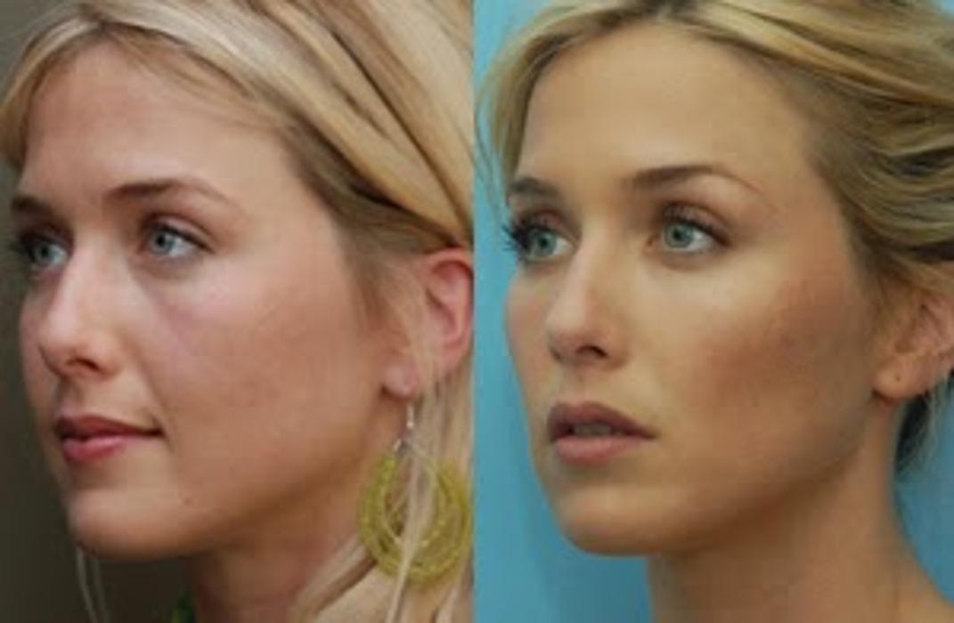 New Radiance Cosmetic Centers - Palm Beach Gardens, FL