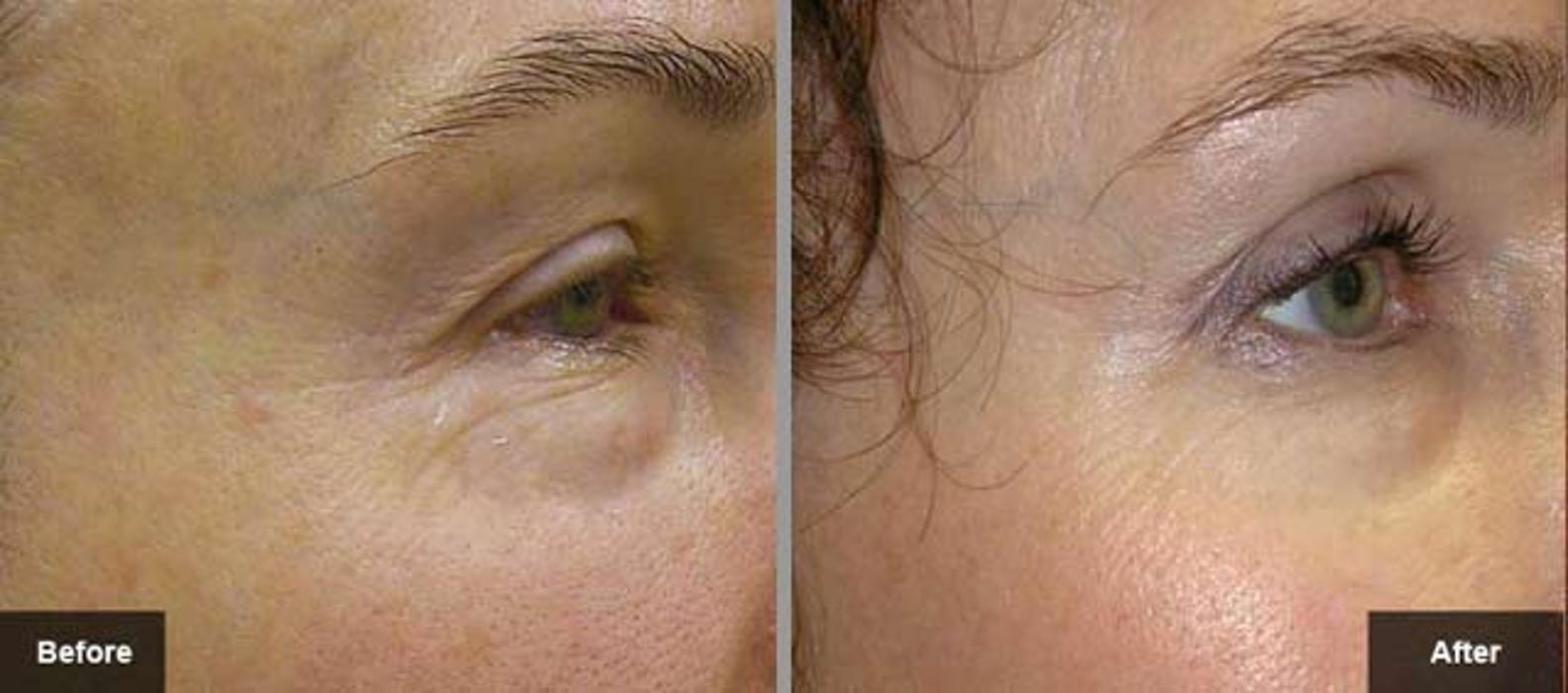 New Radiance Cosmetic Centers - Palm Beach Gardens, FL