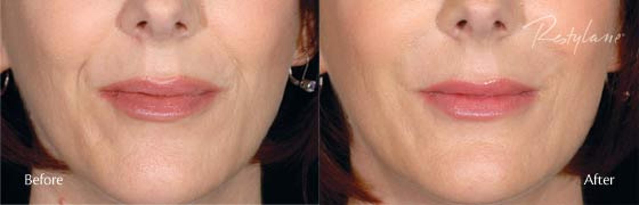 New Radiance Cosmetic Centers - Palm Beach Gardens, FL