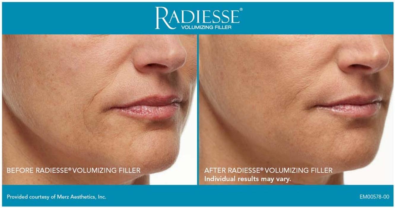 New Radiance Cosmetic Centers - Palm Beach Gardens, FL