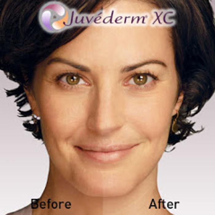 New Radiance Cosmetic Centers - Palm Beach Gardens, FL