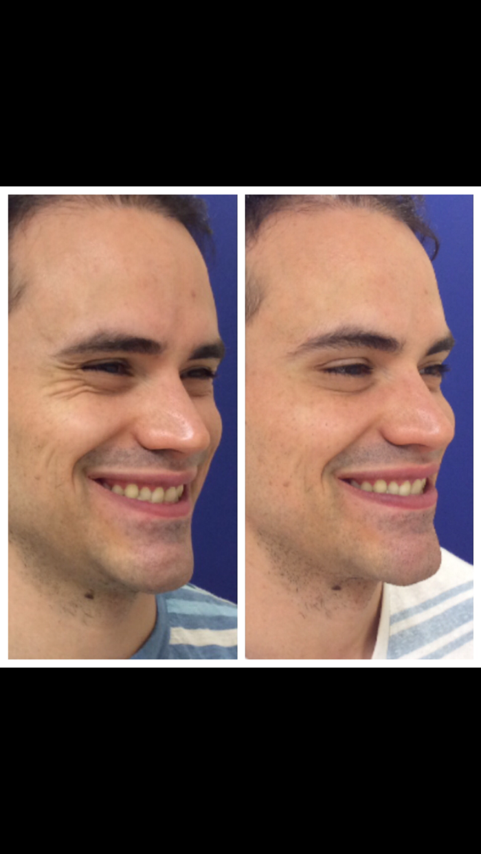 Pu?r Skin Clinic - Edmonds