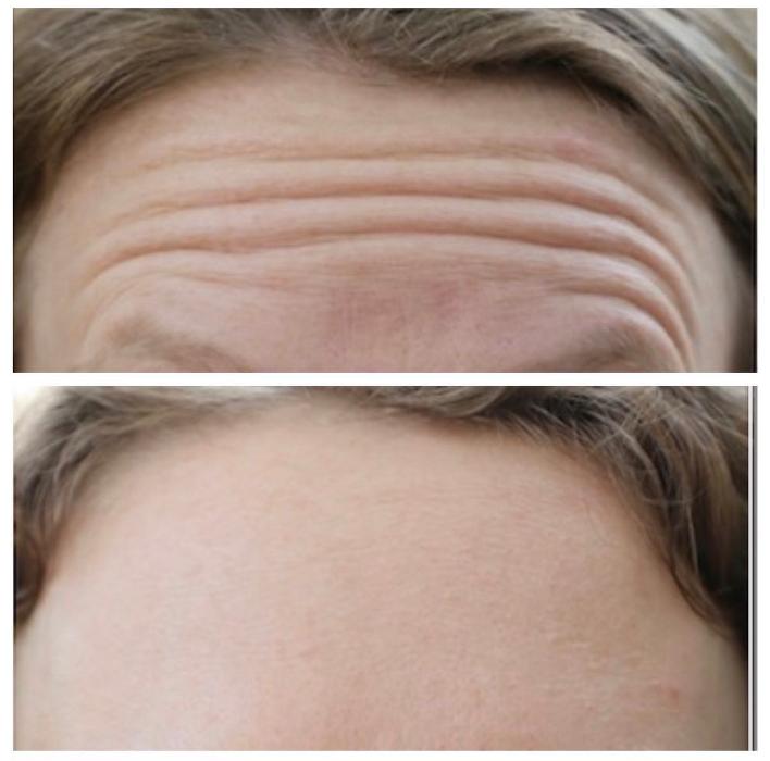 Blush Med Spa - Avon, CT