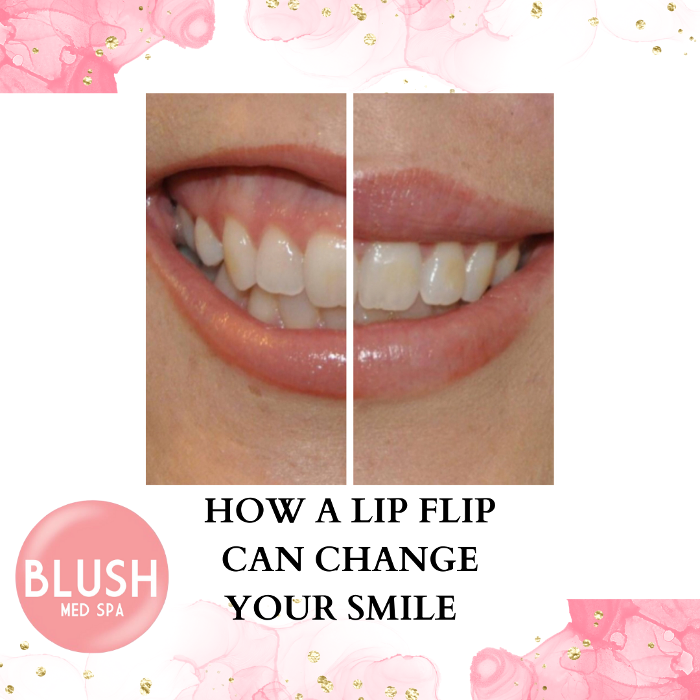 Blush Med Spa - Avon, CT