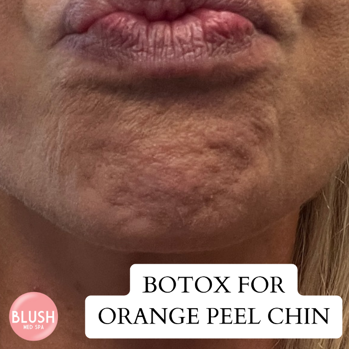 Blush Med Spa - Avon, CT