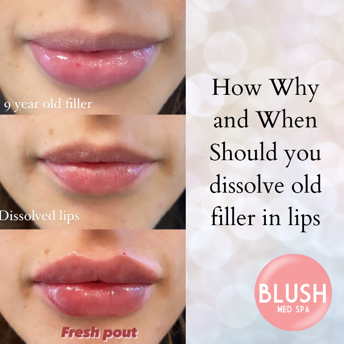 Blush Med Spa - Avon, CT