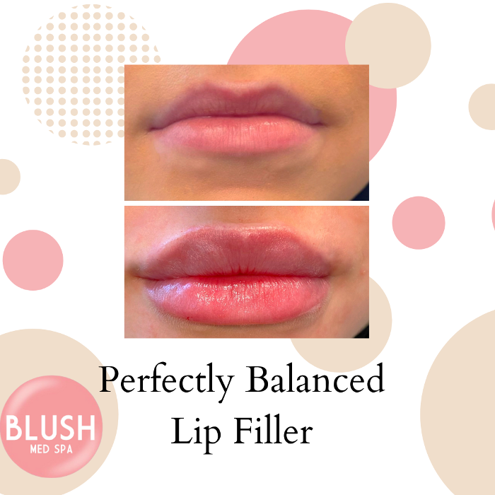 Blush Med Spa - Avon, CT