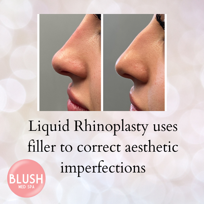 Blush Med Spa - Avon, CT