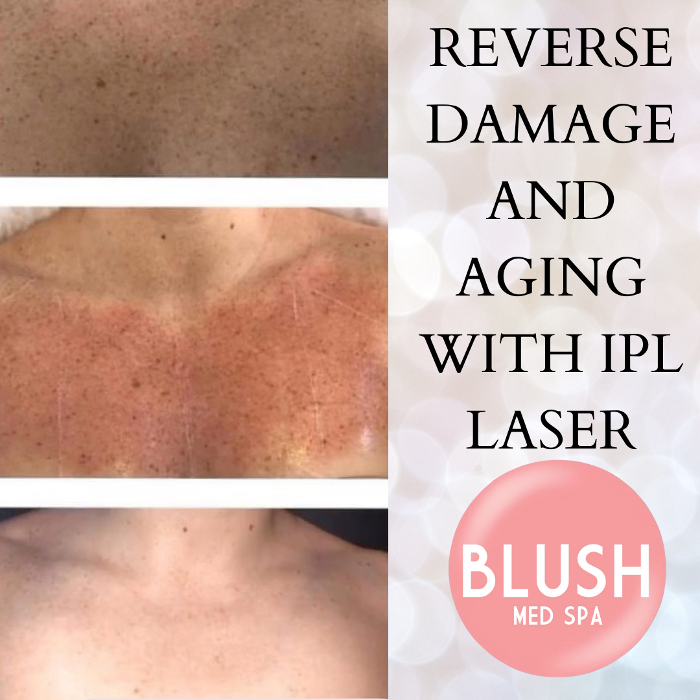 Blush Med Spa - Avon, CT