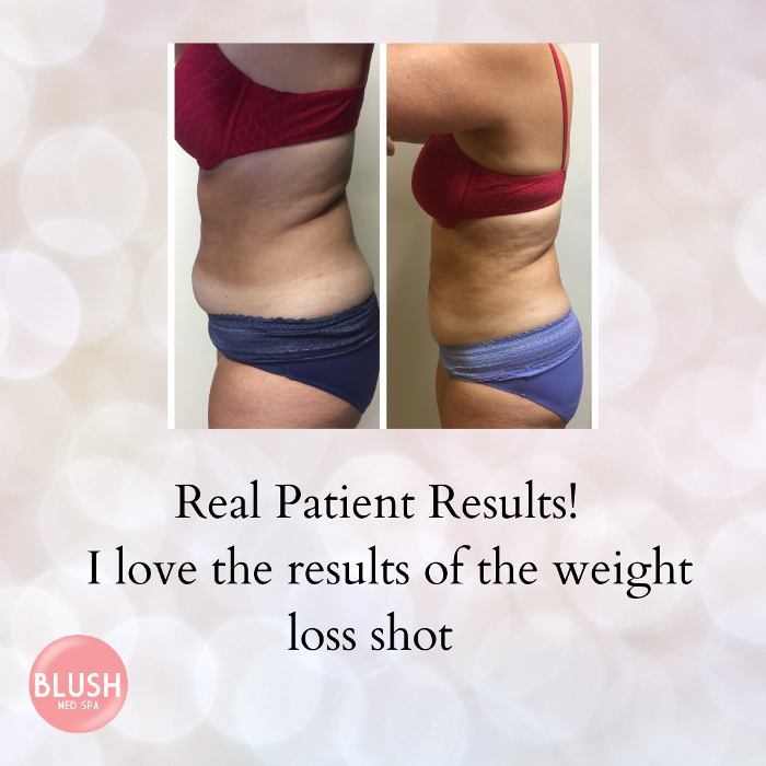 Blush Med Spa - Avon, CT