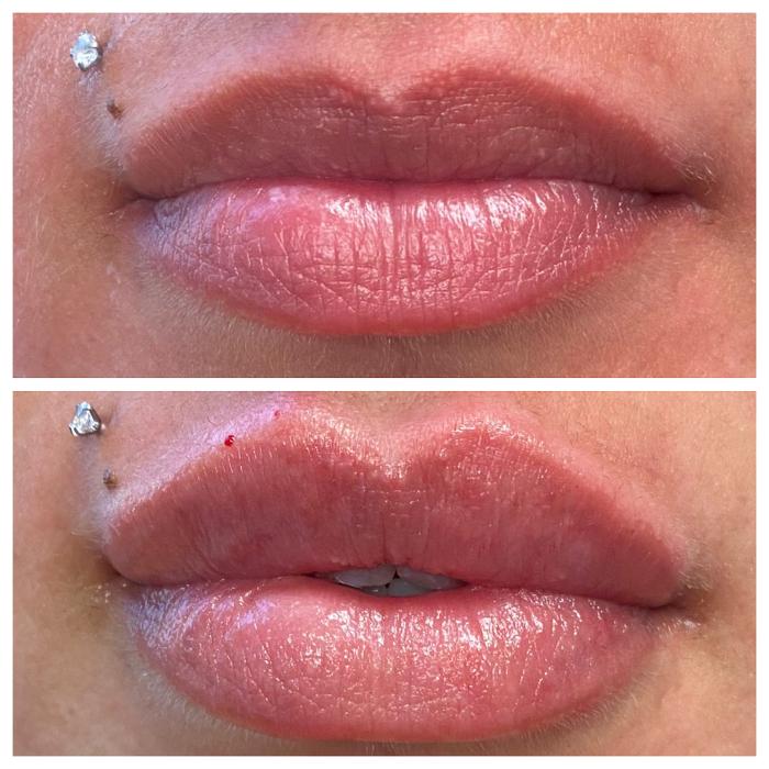 Blush Med Spa - Avon, CT