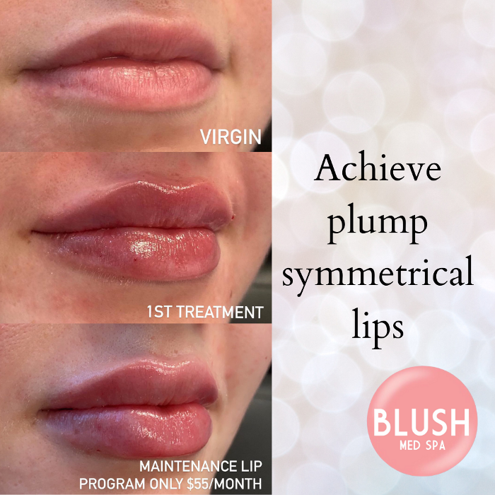 Blush Med Spa - Avon, CT