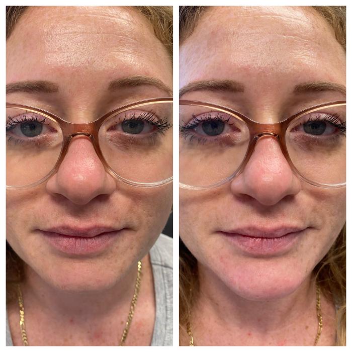 Blush Med Spa - Avon, CT