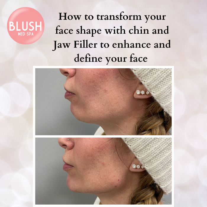 Blush Med Spa - Avon, CT