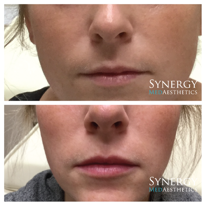 Synergy MedAesthetics - Kennewick, WA