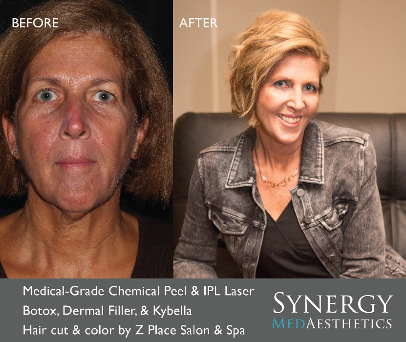 Synergy MedAesthetics - Kennewick, WA