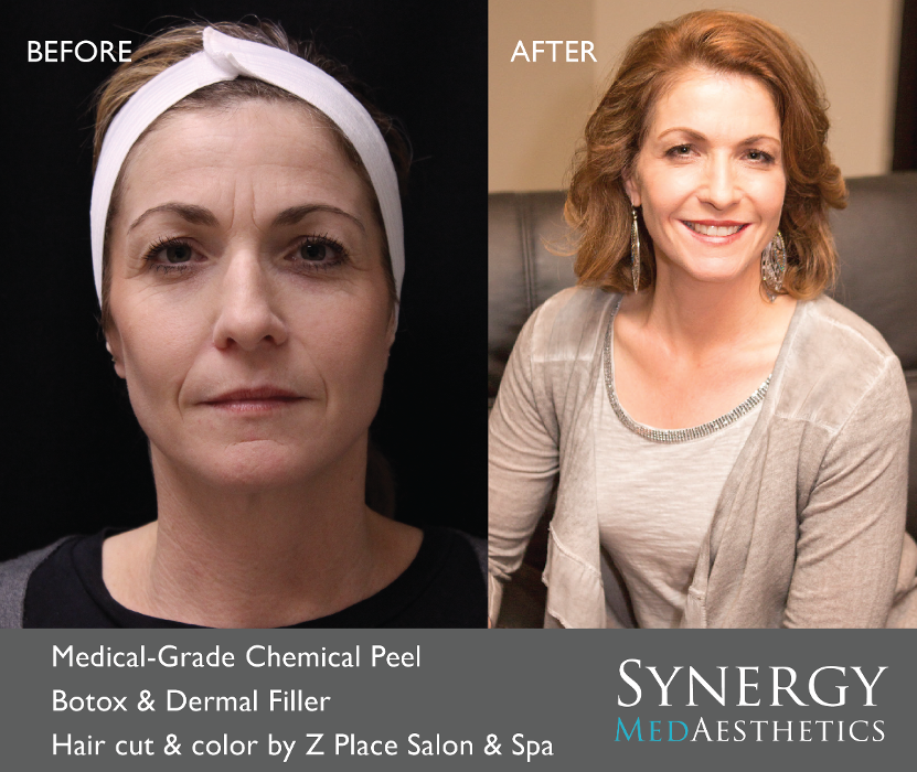 Synergy MedAesthetics - Kennewick, WA