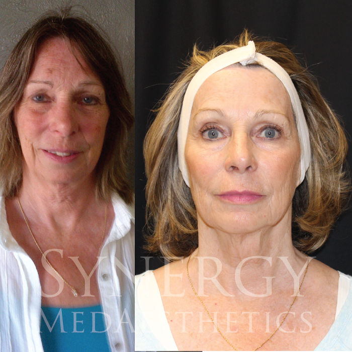 Synergy MedAesthetics - Kennewick, WA