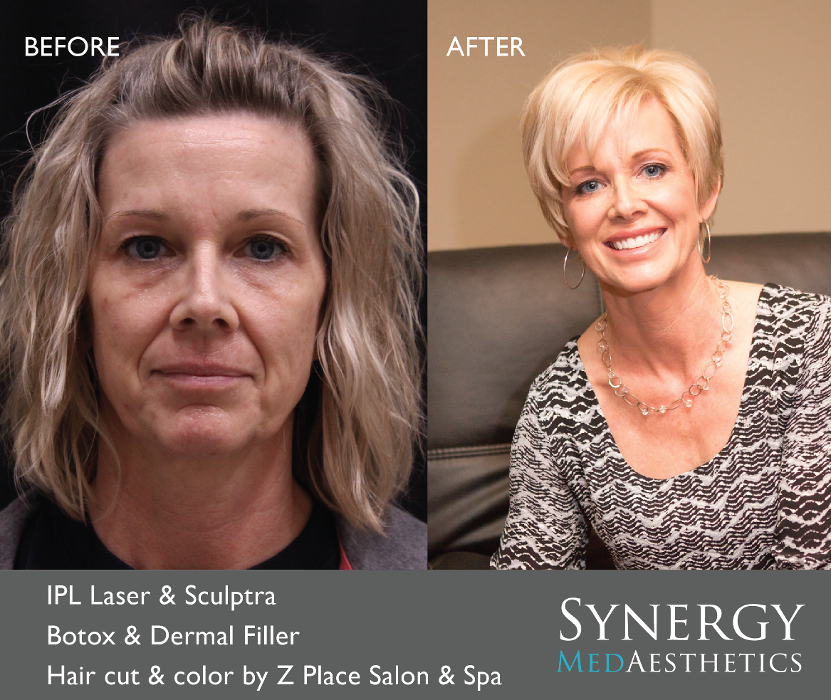 Synergy MedAesthetics - Kennewick, WA