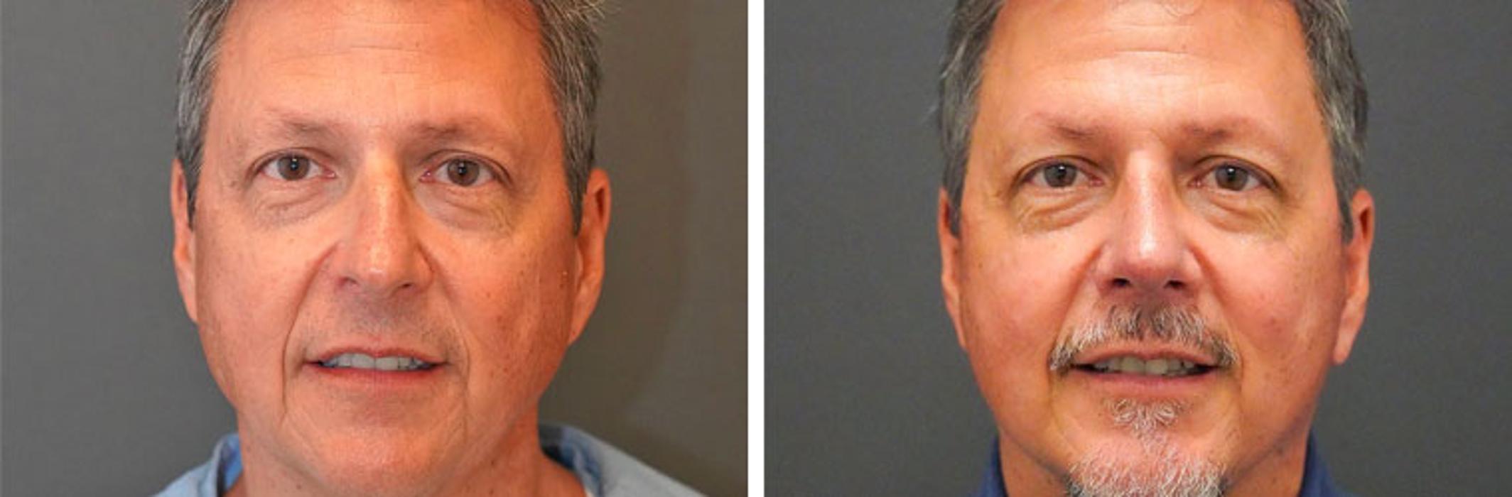 Synergy MedAesthetics - Kennewick, WA