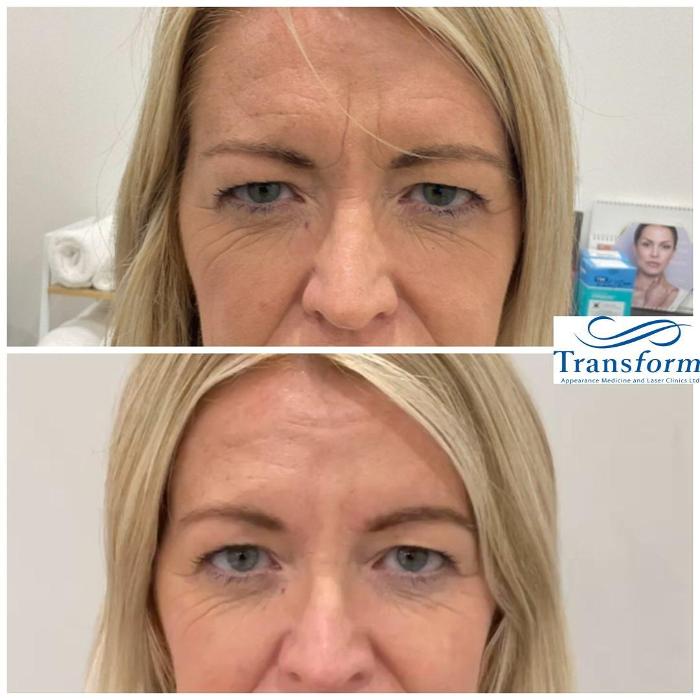 Fotos de Transform Clinic Merivale