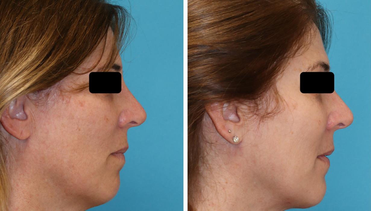 Eugenie Brunner, MD, FACS - Princeton, NJ