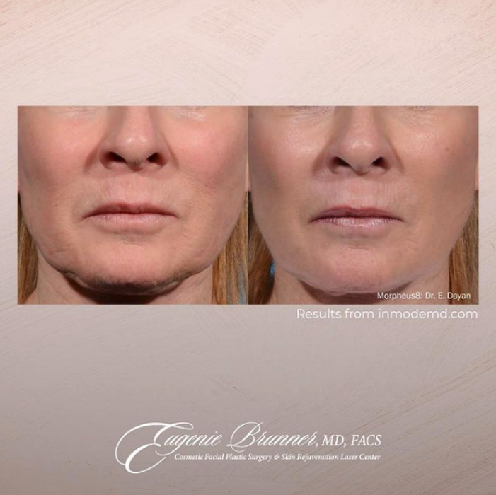 Eugenie Brunner, MD, FACS - Princeton, NJ