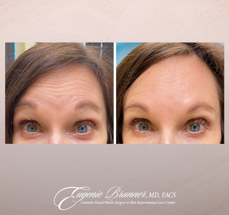 Eugenie Brunner, MD, FACS - Princeton, NJ