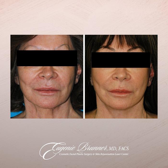 Eugenie Brunner, MD, FACS - Princeton, NJ