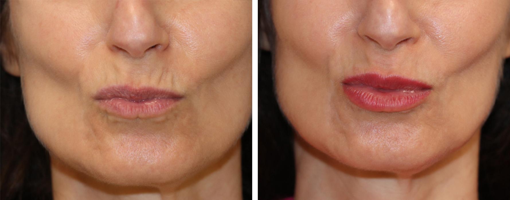 Eugenie Brunner, MD, FACS - Princeton, NJ