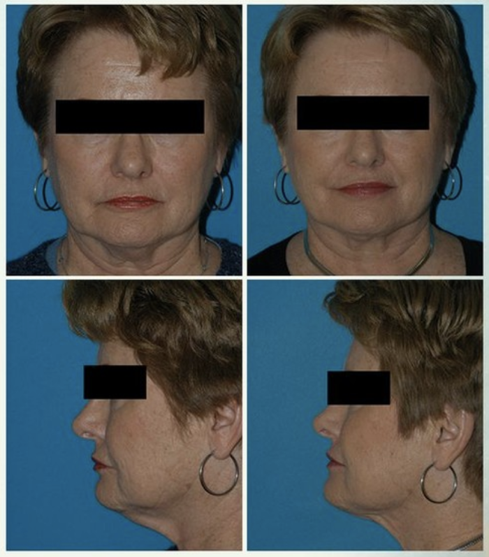 Eugenie Brunner, MD, FACS - Princeton, NJ