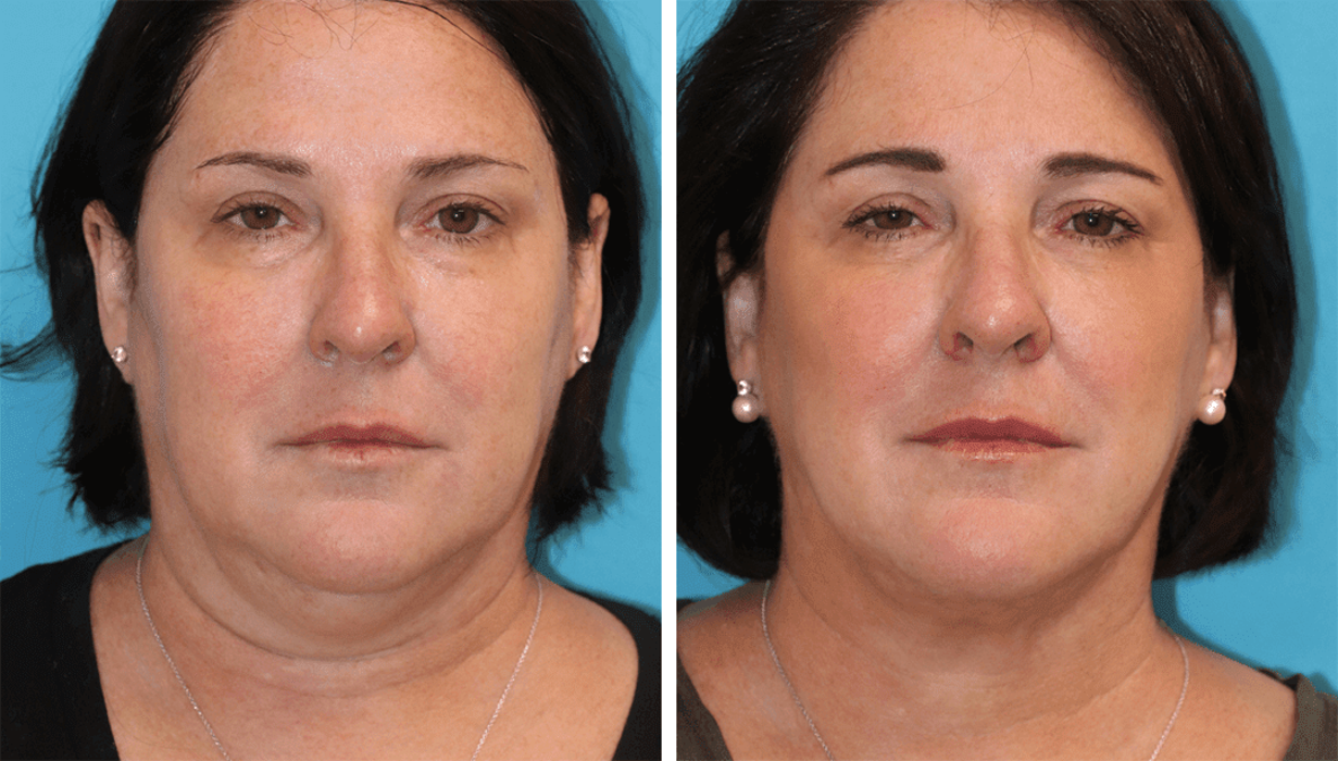 Eugenie Brunner, MD, FACS - Princeton, NJ