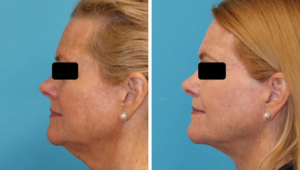 Eugenie Brunner, MD, FACS - Princeton, NJ