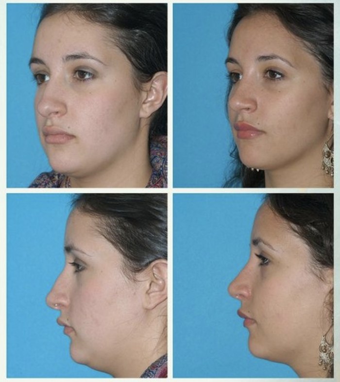 Eugenie Brunner, MD, FACS - Princeton, NJ