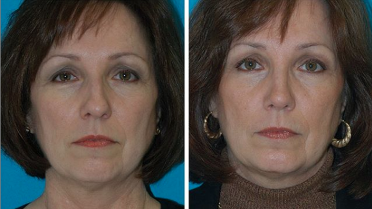 Eugenie Brunner, MD, FACS - Princeton, NJ