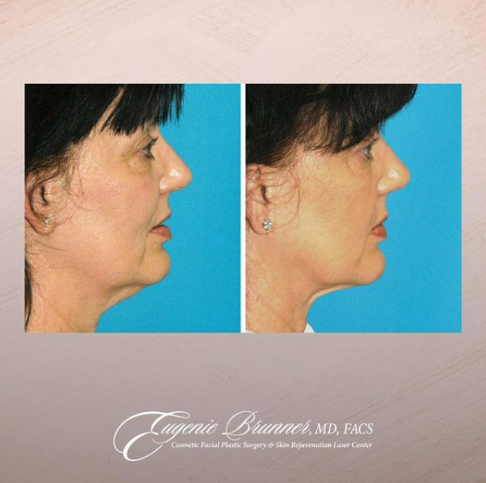 Eugenie Brunner, MD, FACS - Princeton, NJ