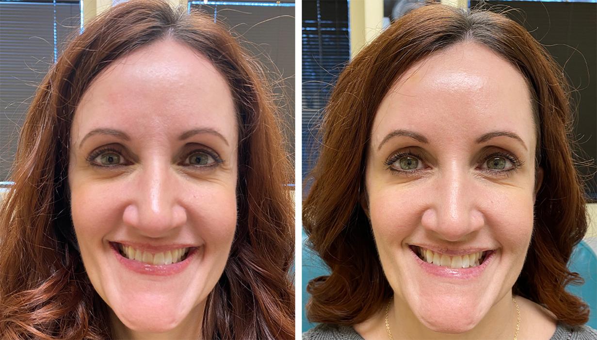 Eugenie Brunner, MD, FACS - Princeton, NJ