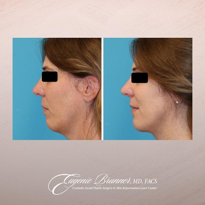 Eugenie Brunner, MD, FACS - Princeton, NJ