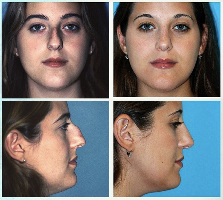 Eugenie Brunner, MD, FACS - Princeton, NJ