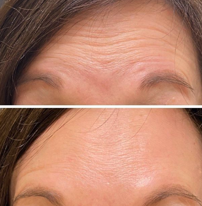 Eugenie Brunner, MD, FACS - Princeton, NJ