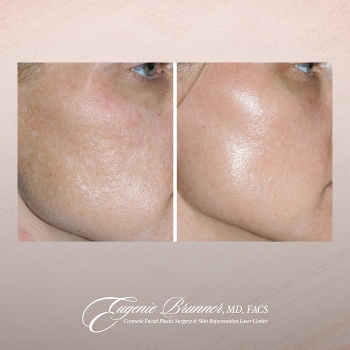 Eugenie Brunner, MD, FACS - Princeton, NJ