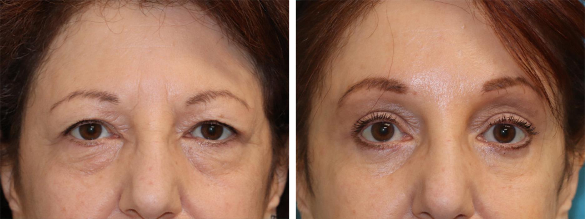 Eugenie Brunner, MD, FACS - Princeton, NJ