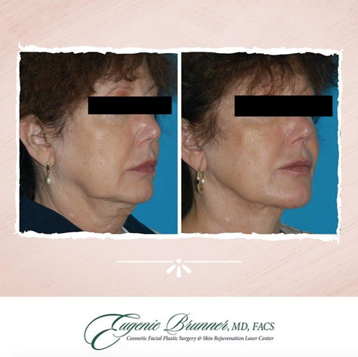 Eugenie Brunner, MD, FACS - Princeton, NJ