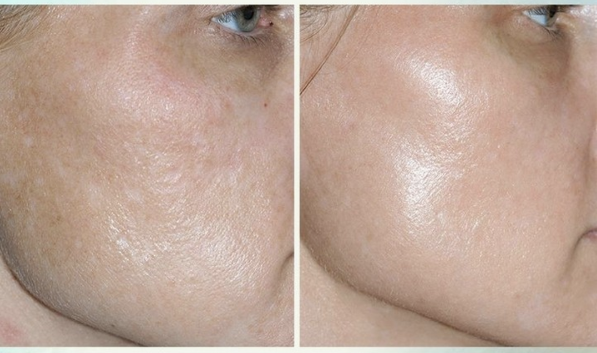 Eugenie Brunner, MD, FACS - Princeton, NJ