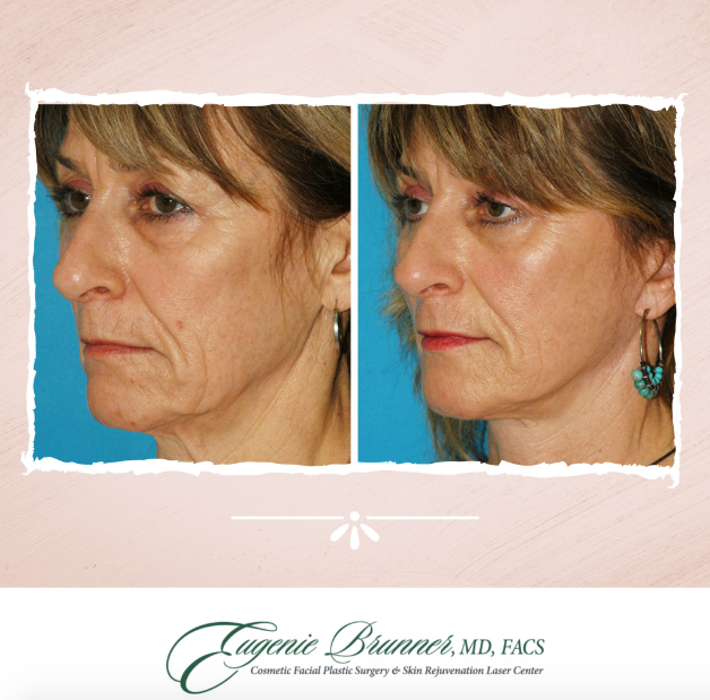 Eugenie Brunner, MD, FACS - Princeton, NJ