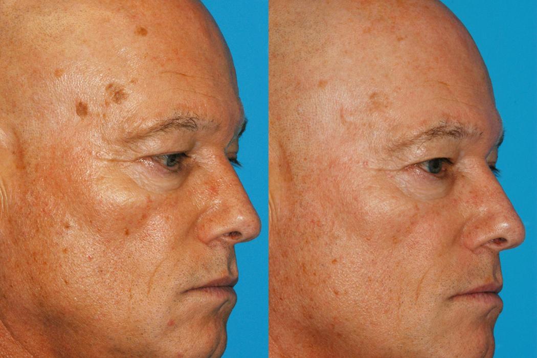 Eugenie Brunner, MD, FACS - Princeton, NJ