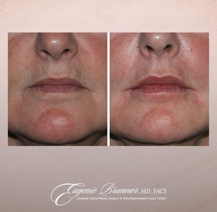 Eugenie Brunner, MD, FACS - Princeton, NJ