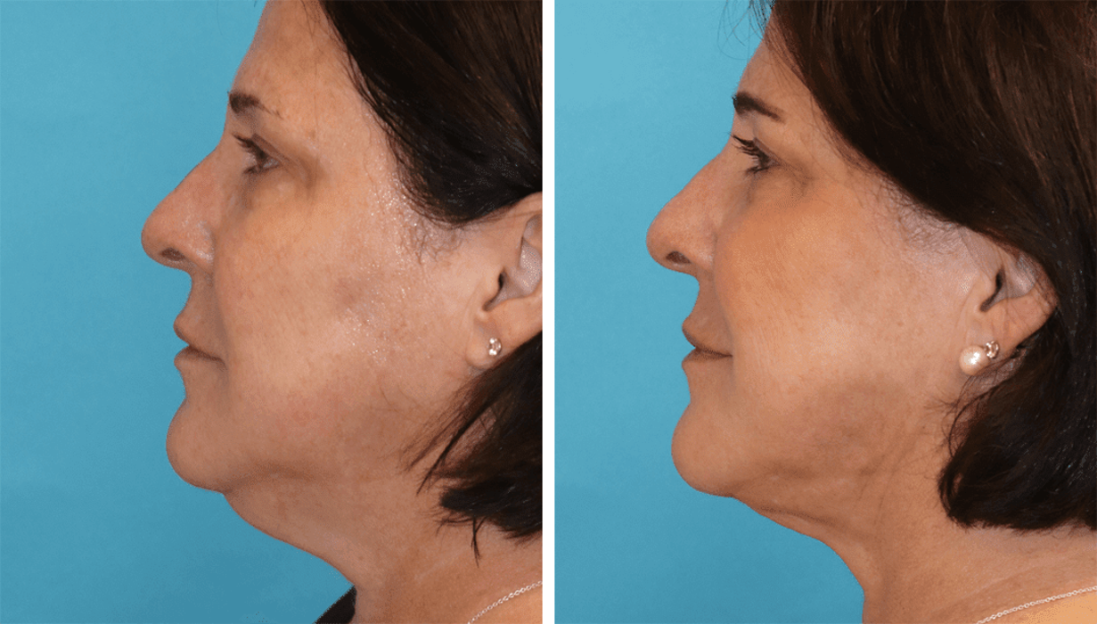 Eugenie Brunner, MD, FACS - Princeton, NJ