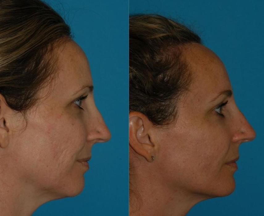 Eugenie Brunner, MD, FACS - Princeton, NJ