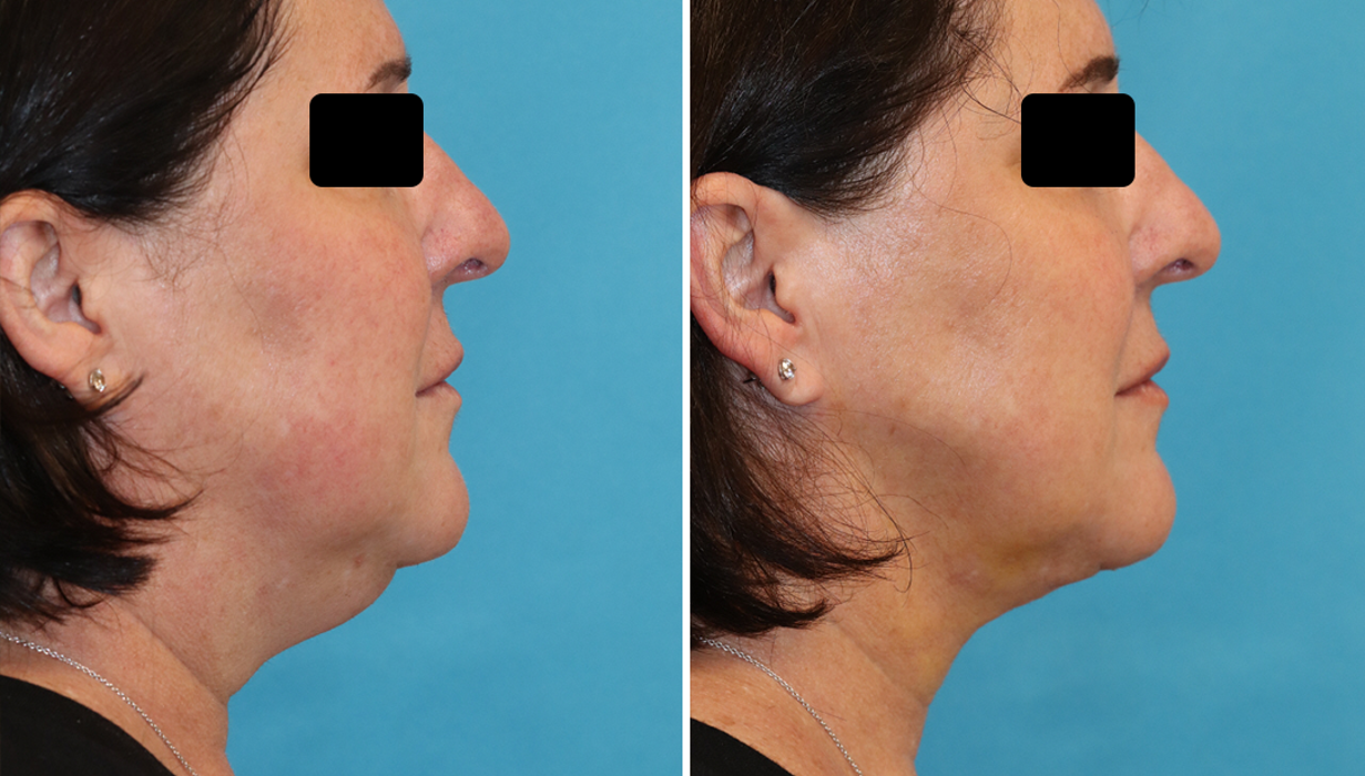 Eugenie Brunner, MD, FACS - Princeton, NJ